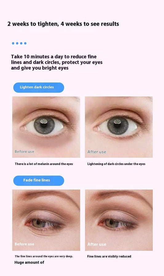 electric eye massager with red blue light - Miel rose luxe