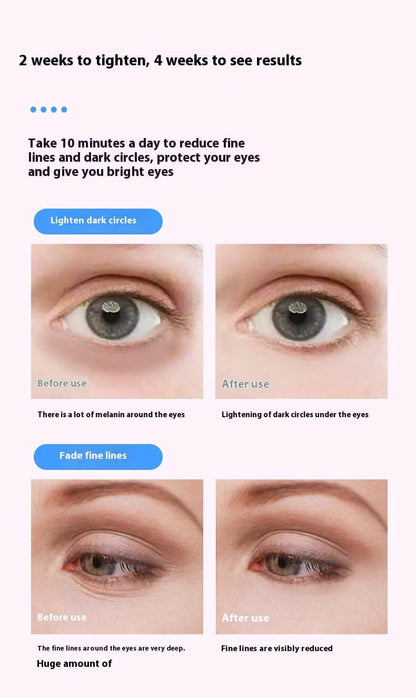 electric eye massager with red blue light - Miel rose luxe