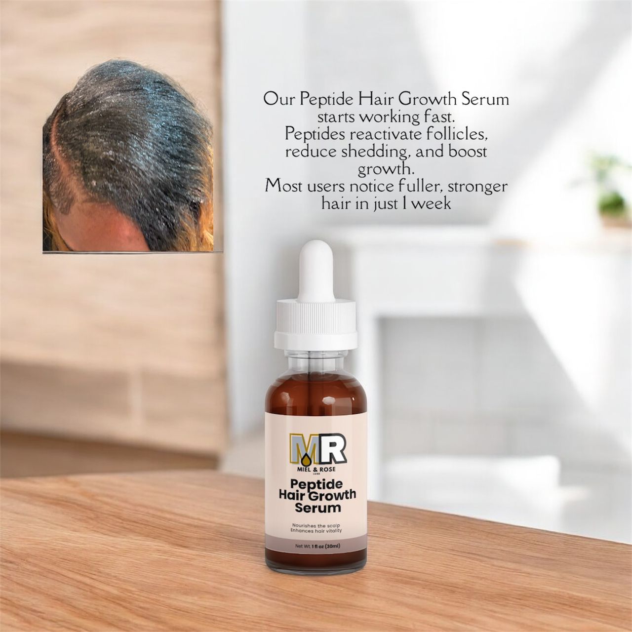 Before and after hair growth results showing fuller roots and healthier, stronger hair after 1 week